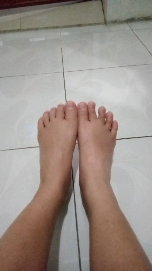 Kaki bengkak