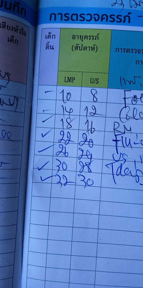 ขออนุญาตสอบถามแม่ๆจ้าคือแบบในรูปเราต้องดูนับตามข้างหน้ารึข้างหลังคะ