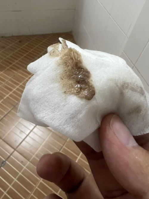 ทีมกันยายนมีใครแอบแตกก่อนแล้วบ้างค่ะ บ้านนี้มีมูกแบบในรูปควรจะไปพบแพทย์ไหมค่ะ แต่ไม่ปวดท้อง