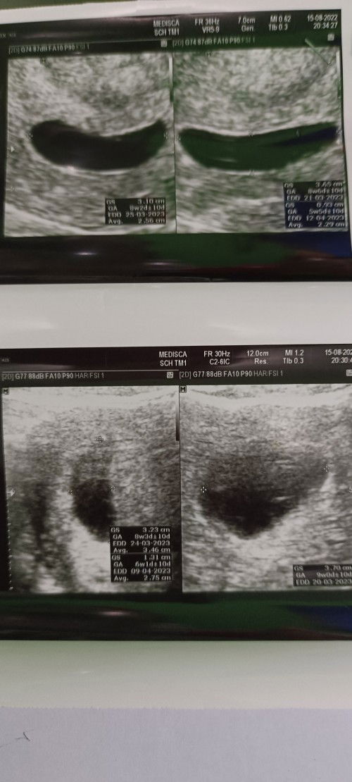 Hamil BO usia kehamilan 9w