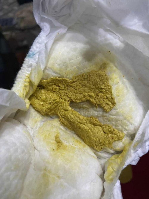 bayi memakai susu formula