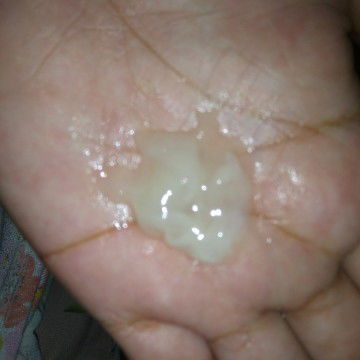 Mucus plug na ba Ito masakit na singit at pwetan