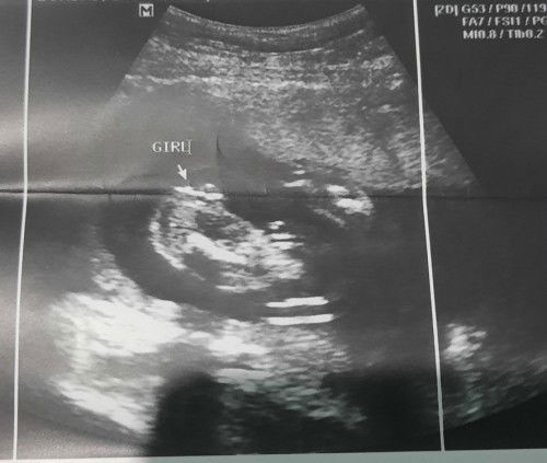 Girl po ba talaga sya? sa tingin nyo po? thanks