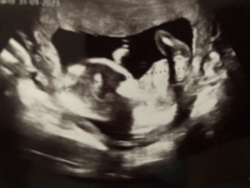 ลูกชายหรือลูกสาวน๊า