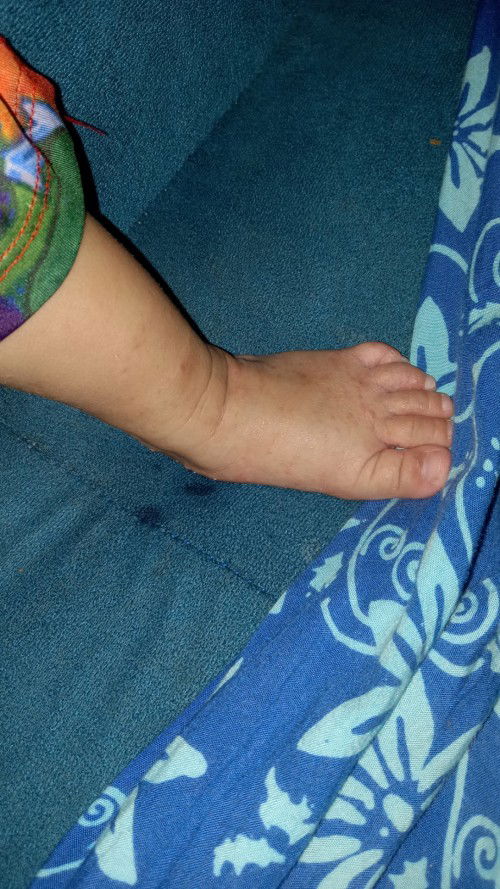 Mau nanya Bun ada yg pernah sama kaya anak saya