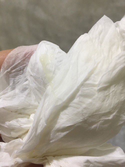 สอบถามแม่ๆหน่อยค่าอันนี้เป็นตกขาวปกติใช่มั้ยคะ ตอนนี้ท้องได้36+4วีค