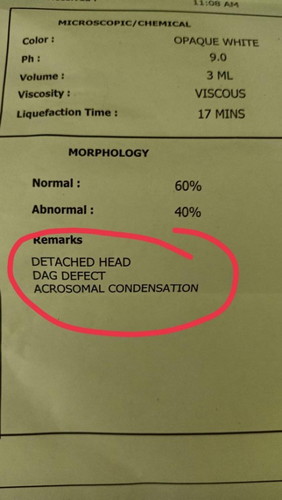 Sperm test results