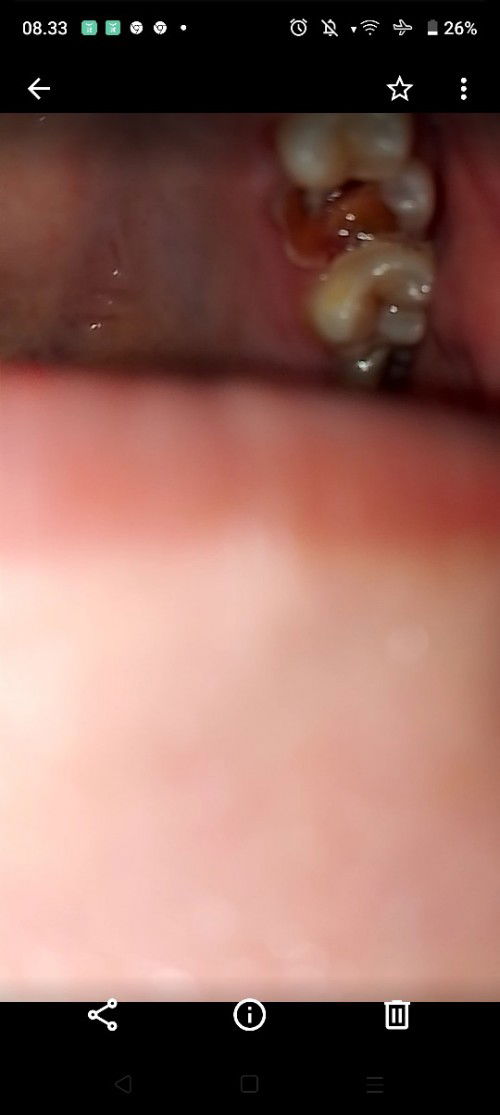 Hamil 14mggu sakit gigi