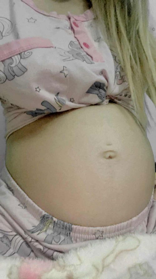 คุณแม่บ้านไหนท้องแบบนี้บ้างคะ