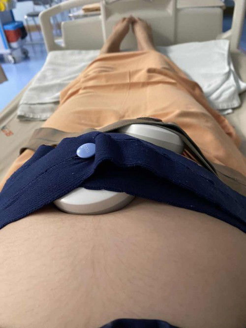 แม่ๆคนไหน คลอดลูกตอน35 weekบ้างคะ ลูกๆเป็นยังไงบ้าง กังวัลมากเลยค่ะ