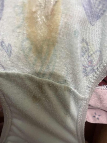 Discharge brown po ba to ?