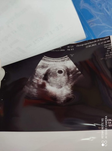 สอบถามหน่อยจ้า