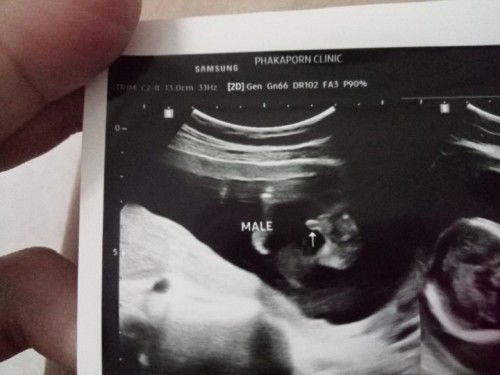 เพศลูกทีม มกราคม66