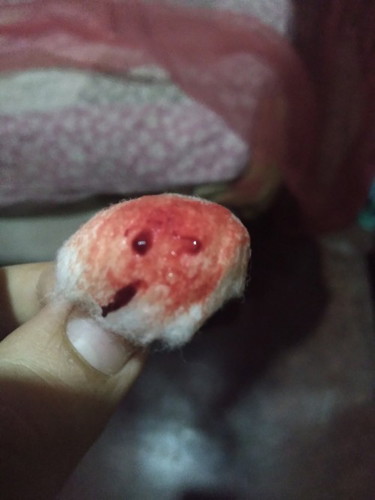 Mga momies ,8days spotting po ako ng start po nung august 9 subrang sakit p9 ng puson ko at pwet ko