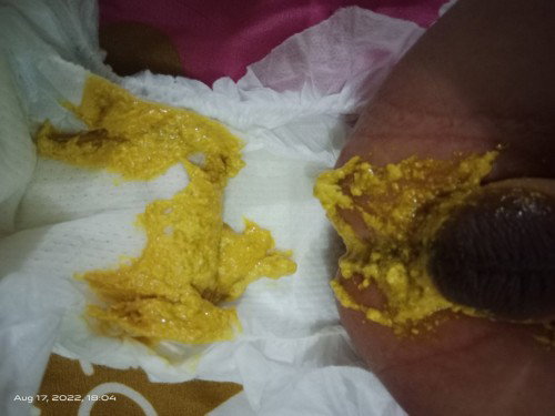 Baby poop normal Po kaya to?
