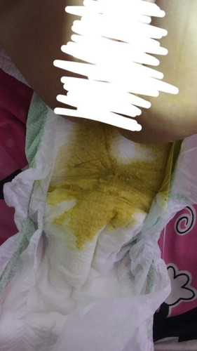 Nagtatae ba si baby?
