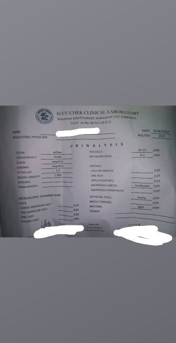 Mali collect ng urine for urine test