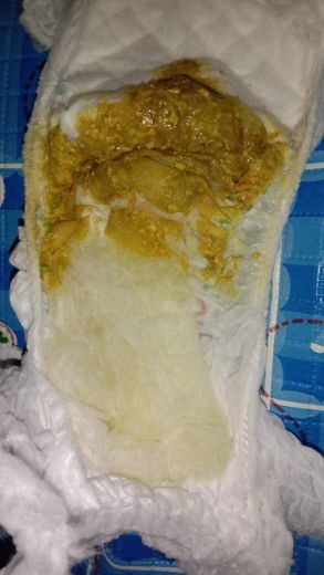 permisi bunda2 apakah pup seperti ini termasuk diare? anaku uda seminggu pup gini