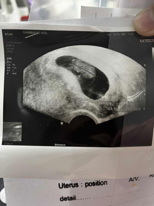 สอบถามทีนะคะ