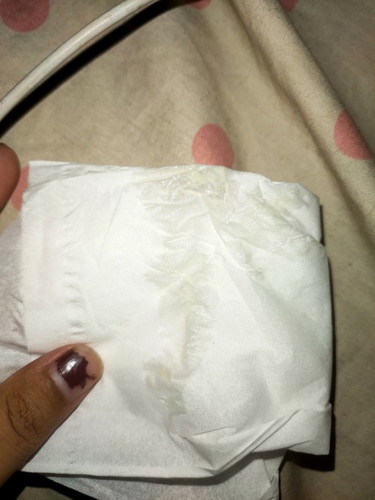 Keputihan di usia hamil 28 weeks bahaya ga ya Bun? Rasanya kadang gatal tapi ga ber Bu