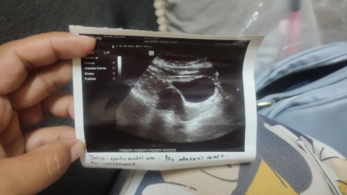 doktor cakap baru 4 minggu sebab tak nampak kantung..Sbb dinding rahim dah nampak menebal