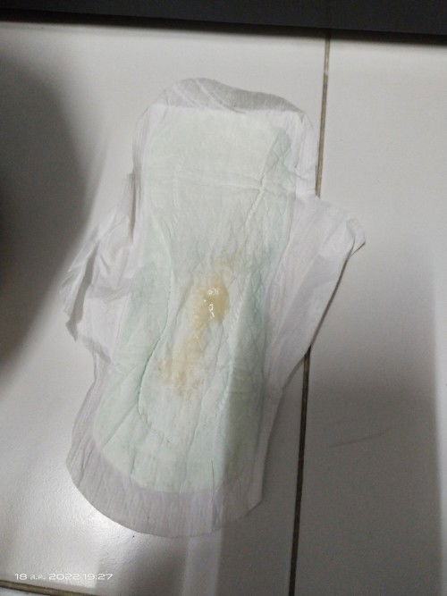 ตกขาวหรือว่าเป็นอะไรกันแน่คะตอนนี้37วิค5วันแล้วค่ะ