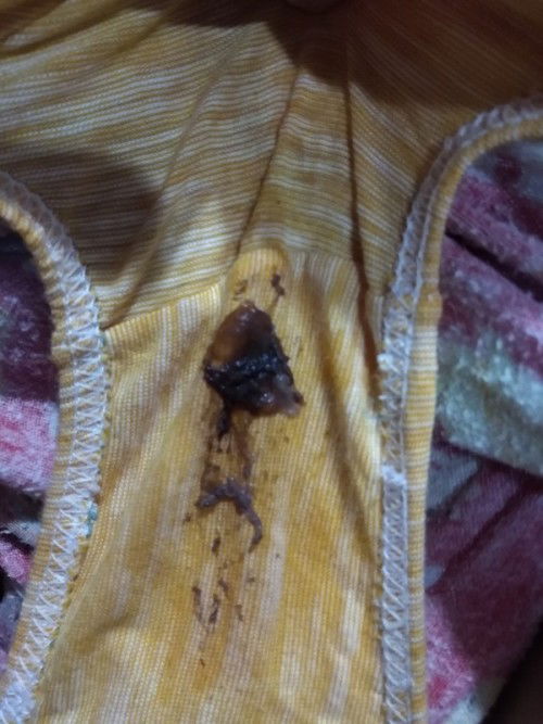 Mucus plug na po ba to??