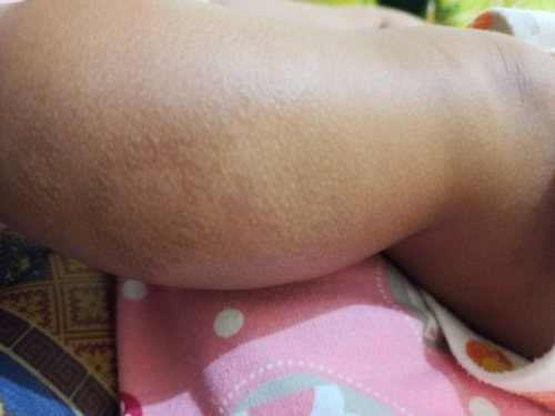 Kulit bayi