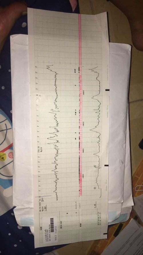 ต้องรออีกนานไหม ถึงจะคลอดค่ะ แม่ๆ