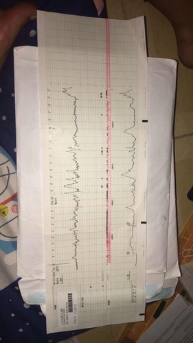ต้องรออีกนานไหม ถึงจะคลอดค่ะ แม่ๆ