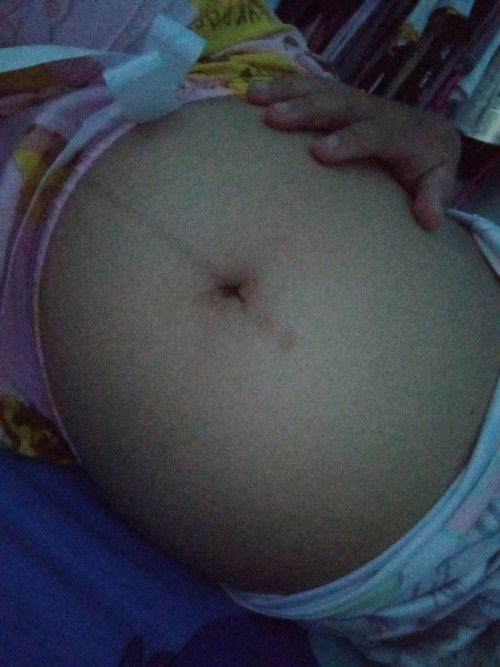 คนท้องต้องสะดือปลิ้นโผล่ออกมาทุกคนไหมคะ