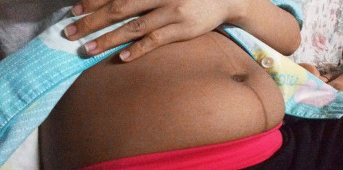 Pagiging itim ng tyan pagkatapos manganak