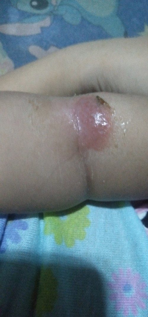 Sana po may makasagot😭