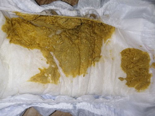 Mga mommy, tanong lang po.