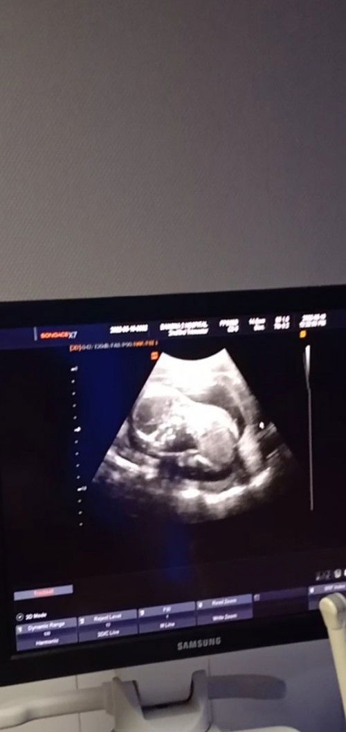 หญิงหรือชายคะ