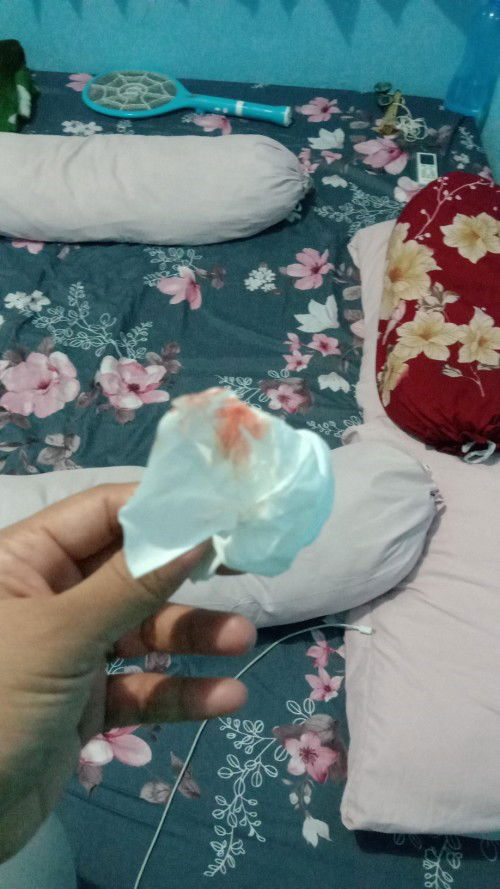 Keluar lendir dan darah disertai mulas