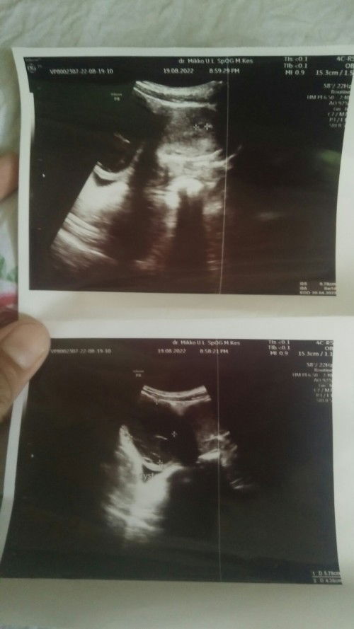 Bantu dan kasih pengalamannya bunda-bunda