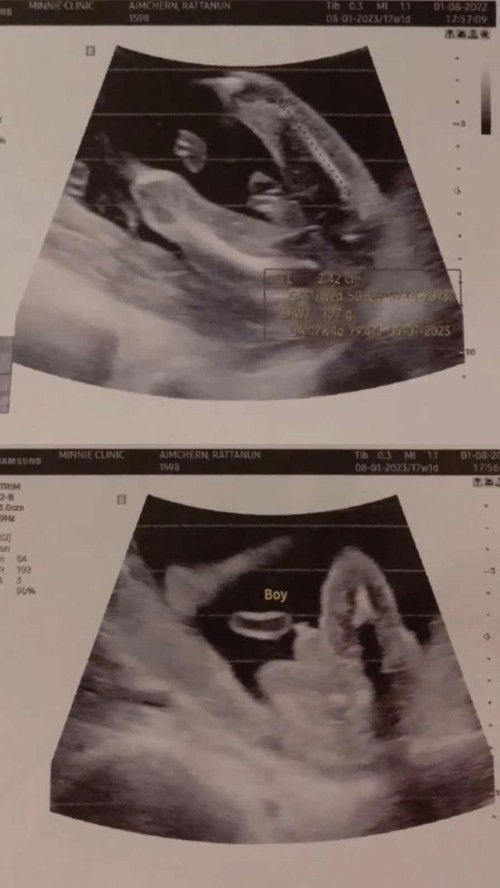 สอบถามเพศลูกหน่อยค่ะแม่