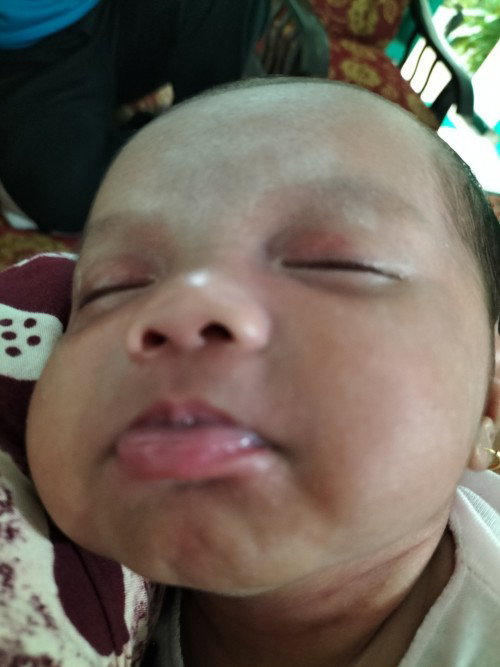 Dok kenapa pipi bayi ank saya gemuk apa krna susu dok TRIms..