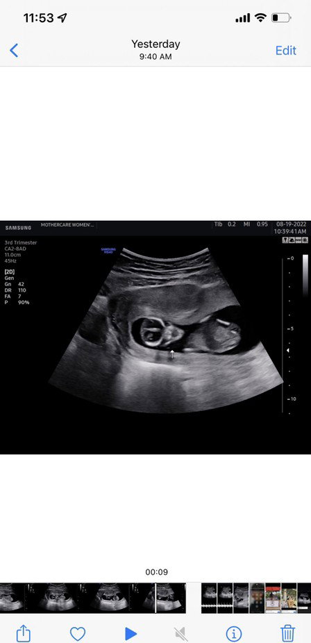 Gender Prediction!