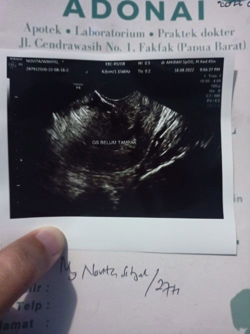 Memasuki 5 minggu awal