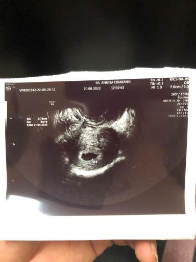 Bertanya2 apa hamil atau tidak akhirnya terjawab