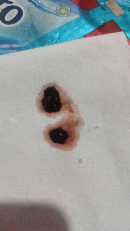 Flek gumpal coklat hitam