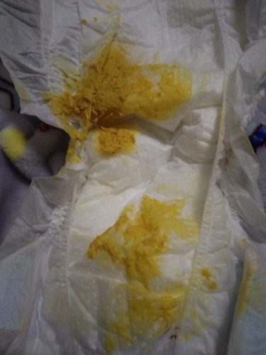 น้องถ่ายเป็นก้อนแล้วมีเม็ดๆ