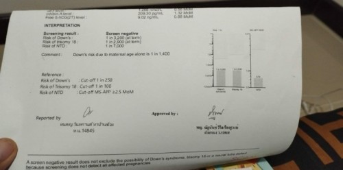 ตรวจดาวน์ซินโดรม อยากสอบถามแม่ๆคะ