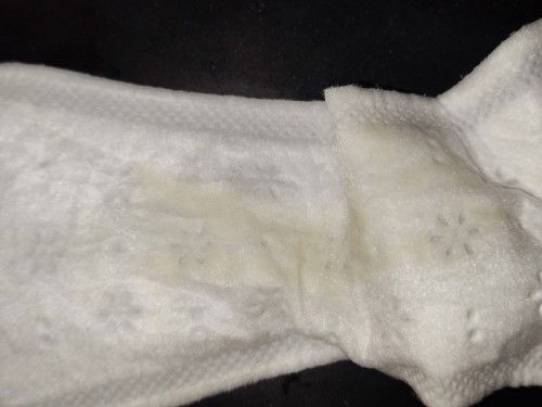 MUCUS PLUG AND WATER DISCHARGE