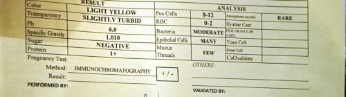 Urinalysis result.