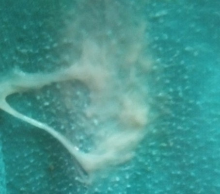 Normal lang ba na sobrang daming lumalabas na ganyan pag buntis I'm 32 weeks pregnant