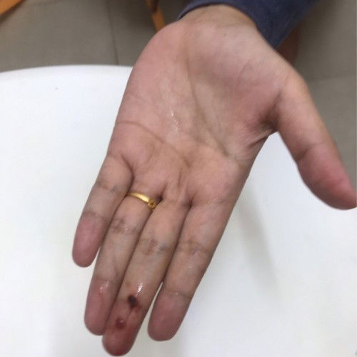 spotting dah pergi hosp kantung ada lagi..kena tunggu 2 minggu lagi untuk scan lagi skli..
#ttc5year