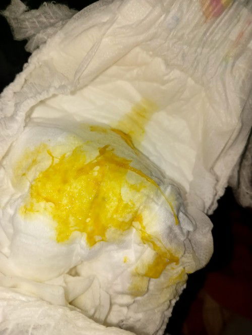 Bun klo pup bayi kuning ada lendir ny,bhya gk bun,ank ny gk rewel dan demam.apa perlu dkasih obat?